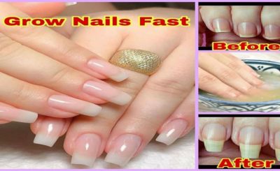 How to Grow Nails Fast at Home