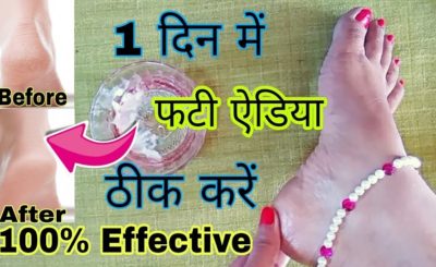 Get Rid of Cracked Heels at Home In Hindi